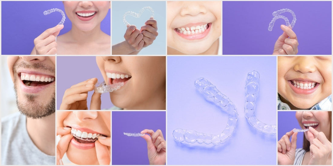 The Complete Guide to Cleaning Retainers, Aligners, and Dentures